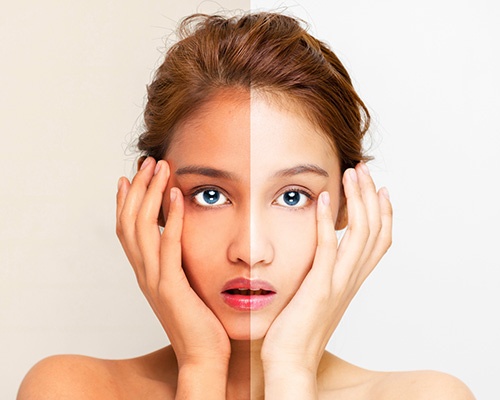 Как выбрать крем от пигментации на лице: советы косметологов